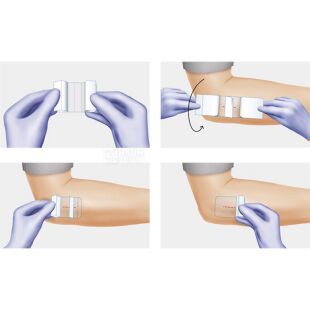 Hartmann Hydrofilm, 10 шт., Пов’язка плівкова прозора для закриття ран, стерильна, 150 мм х 100 мм 