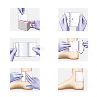 Hartmann Omnifix Elastic, Пластир еластичний з нетканого полотна, білий, 100 мм х 2 м